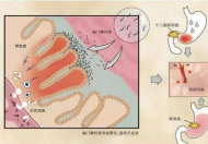 关于幽门螺杆菌的研究，又有了新的发现